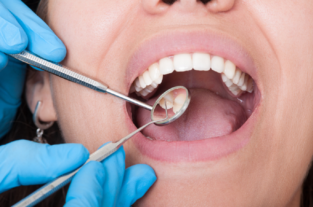 牙冠修复的方法有哪些？